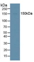 Polyclonal Antibody to Probable ATP-dependent RNA Helicase DDX58 (DDX58)