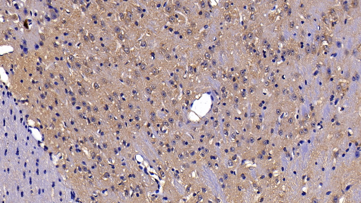 Polyclonal Antibody to Probable ATP-dependent RNA Helicase DDX58 (DDX58)