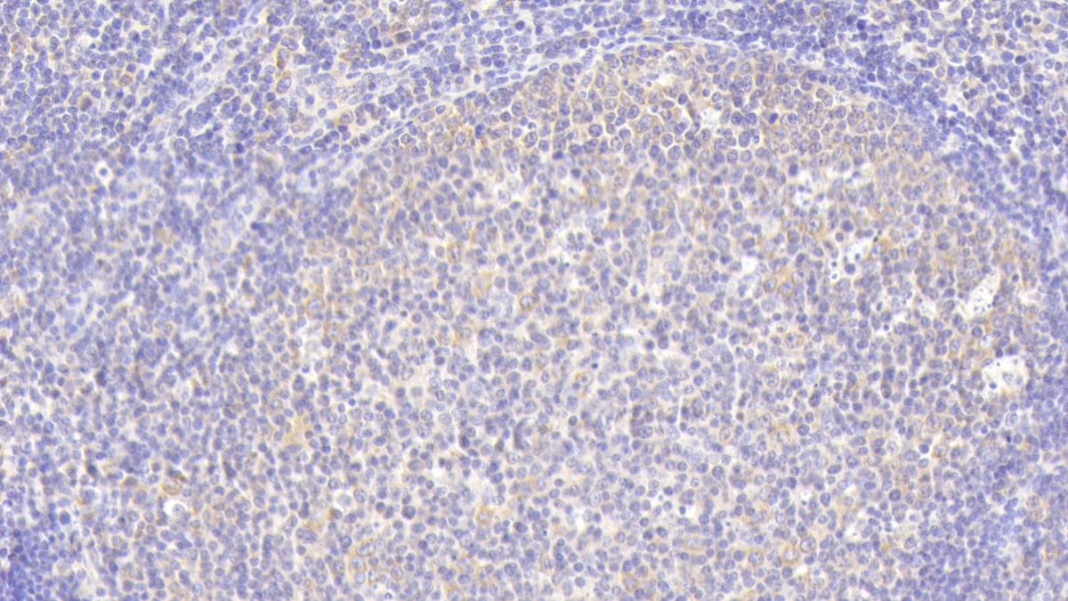 Polyclonal Antibody to Chemokine C-C-Motif Receptor 1 (CCR1)