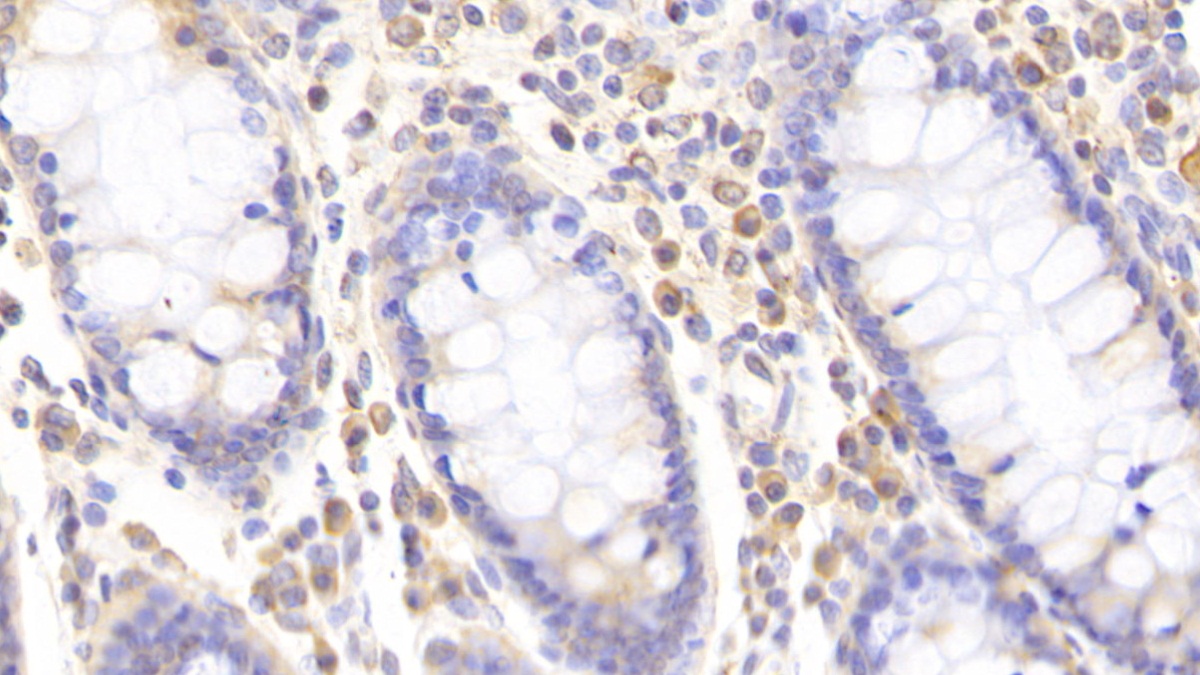 Polyclonal Antibody to Chemokine C-C-Motif Receptor 1 (CCR1)