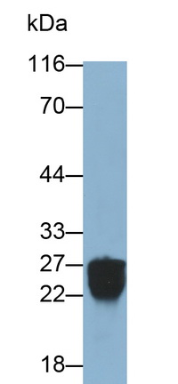 Polyclonal Antibody to Protease, Serine 2 (PRSS2)