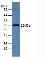 Polyclonal Antibody to Protease, Serine 2 (PRSS2)