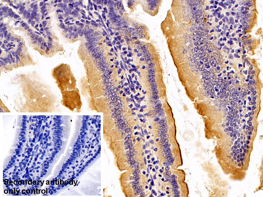 Polyclonal Antibody to Protease, Serine 2 (PRSS2)