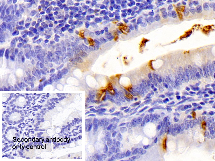 Polyclonal Antibody to Protease, Serine 2 (PRSS2)