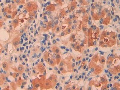 Polyclonal Antibody to Gamma-cystathionase (CTH)