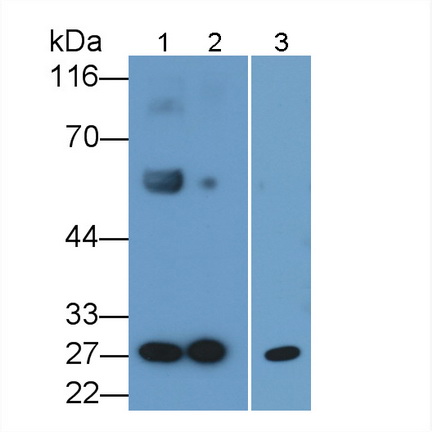 Polyclonal Antibody to Serum Amyloid P Component (SAP)