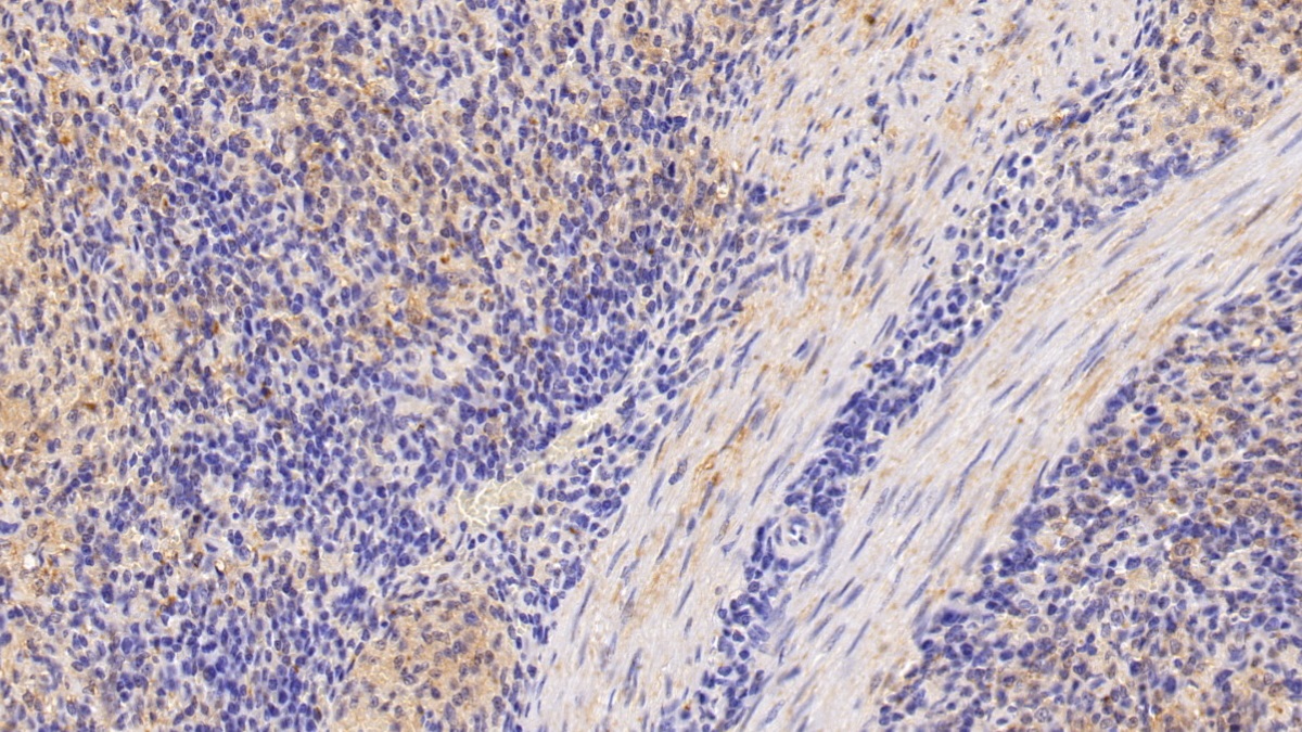 Polyclonal Antibody to Serum Amyloid P Component (SAP)