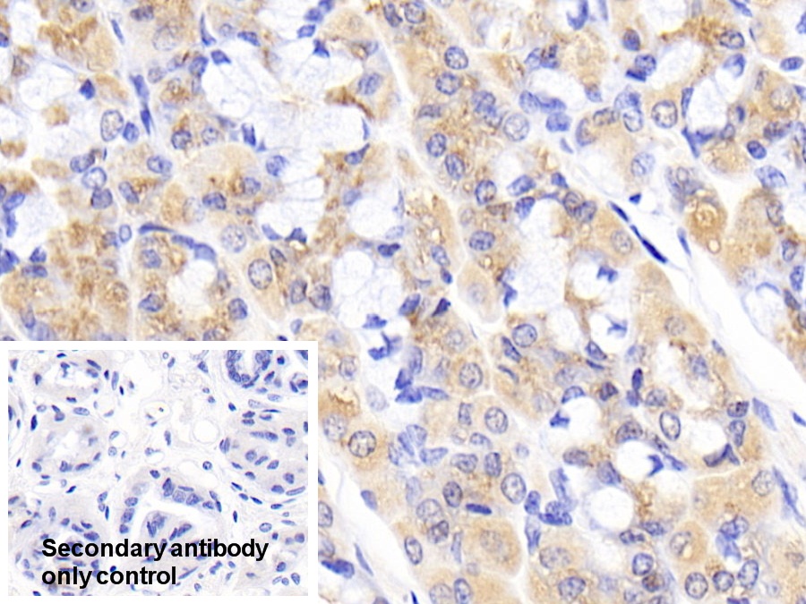 Polyclonal Antibody to Serum Amyloid P Component (SAP)