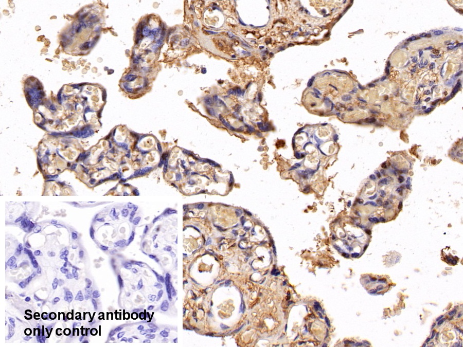 Polyclonal Antibody to Serum Amyloid P Component (SAP)