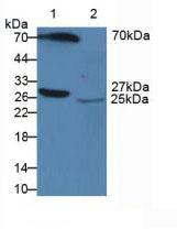 Polyclonal Antibody to Serum Amyloid P Component (SAP)