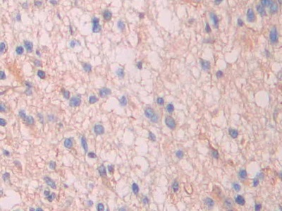 Polyclonal Antibody to Serum Amyloid P Component (SAP)