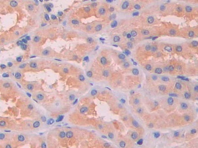 Polyclonal Antibody to Serum Amyloid P Component (SAP)