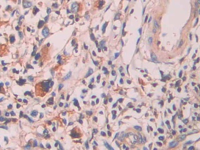 Polyclonal Antibody to Serum Amyloid P Component (SAP)