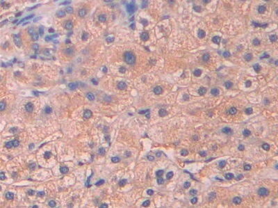 Polyclonal Antibody to Serum Amyloid P Component (SAP)