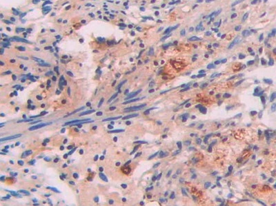 Polyclonal Antibody to Serum Amyloid P Component (SAP)