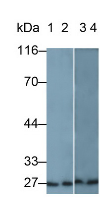 Polyclonal Antibody to Serum Amyloid P Component (SAP)