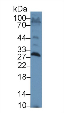 Polyclonal Antibody to Serum Amyloid P Component (SAP)