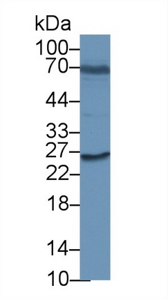 Polyclonal Antibody to Serum Amyloid P Component (SAP)