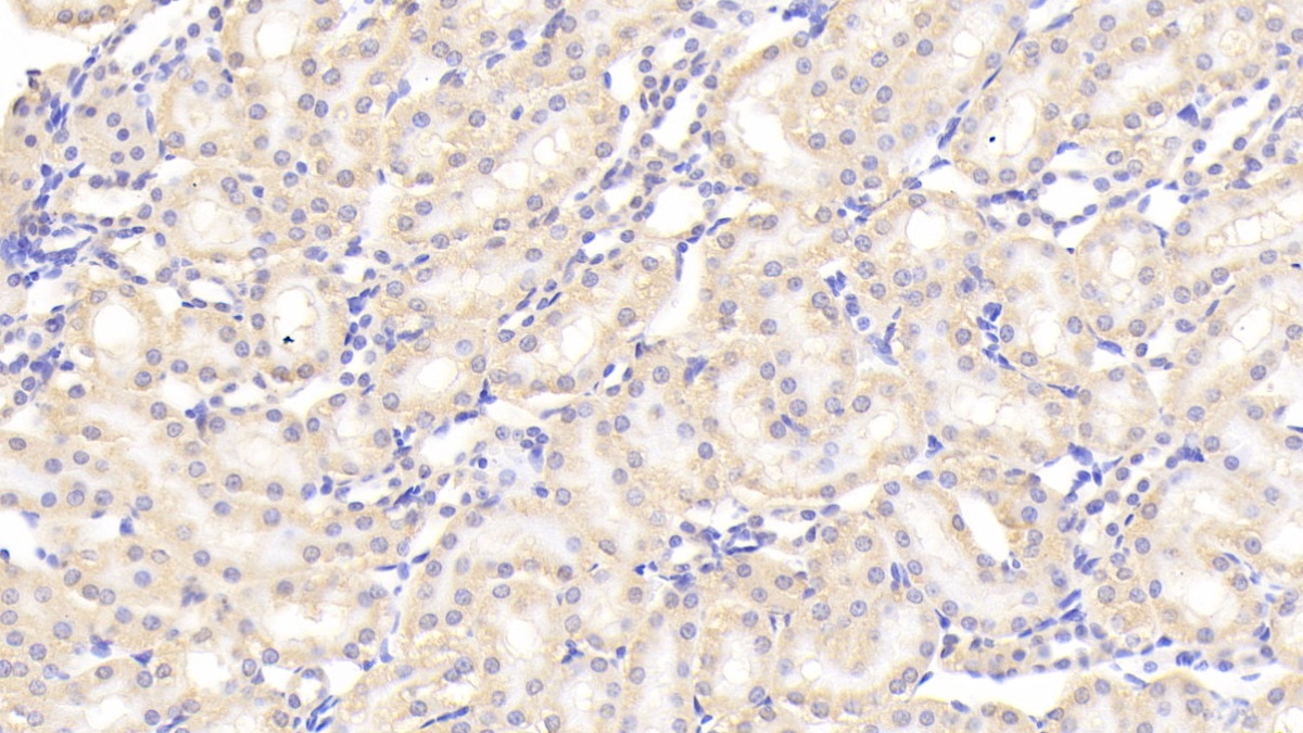 Polyclonal Antibody to Serum Amyloid P Component (SAP)