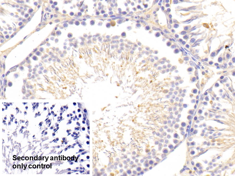 Polyclonal Antibody to Serum Amyloid P Component (SAP)