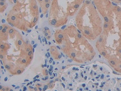 Polyclonal Antibody to Cluster Of Differentiation 147 (CD147)