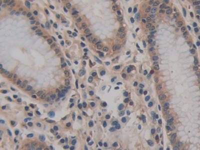 Polyclonal Antibody to Cluster Of Differentiation 147 (CD147)