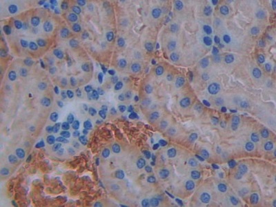 Polyclonal Antibody to Cluster Of Differentiation 147 (CD147)