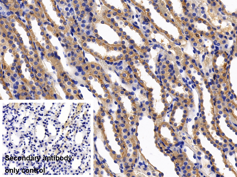 Polyclonal Antibody to Cluster Of Differentiation 147 (CD147)