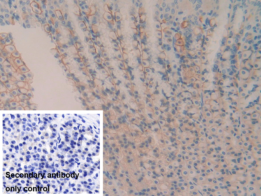 Polyclonal Antibody to Cluster Of Differentiation 147 (CD147)