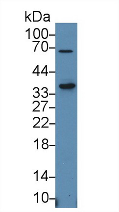 Polyclonal Antibody to Signaling Lymphocytic Activation Molecule Family, Member 1 (SLAMF1)