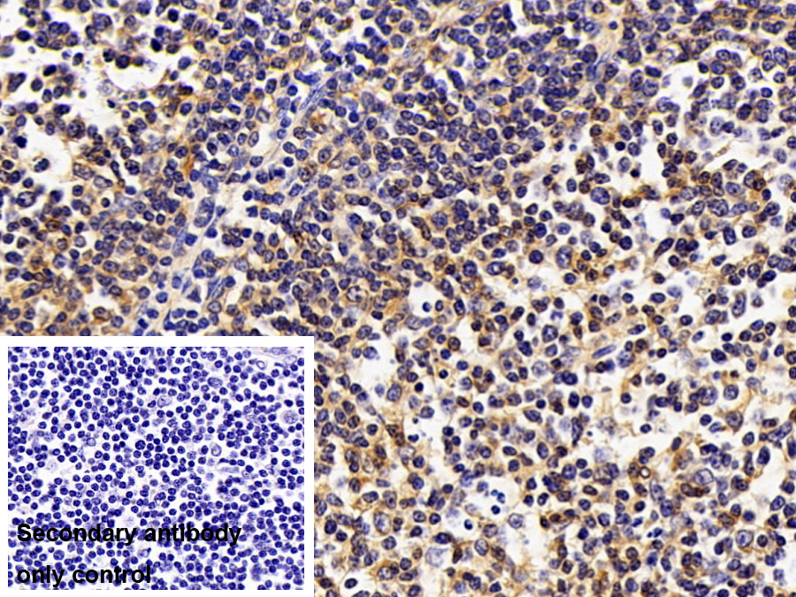 Polyclonal Antibody to Indoleamine-2,3-Dioxygenase (IDO)