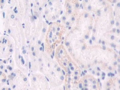 Polyclonal Antibody to Indoleamine-2,3-Dioxygenase (IDO)