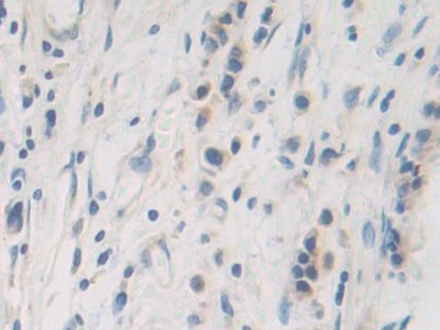 Polyclonal Antibody to Peptidylprolyl Isomerase F (PPIF)