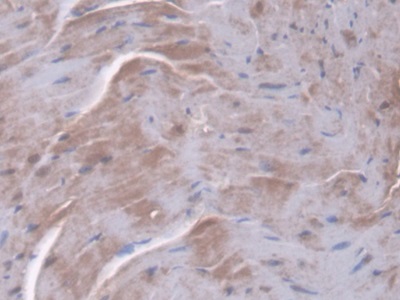 Polyclonal Antibody to Peptidylprolyl Isomerase F (PPIF)