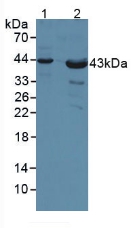 Polyclonal Antibody to Poliovirus Receptor (PVR)