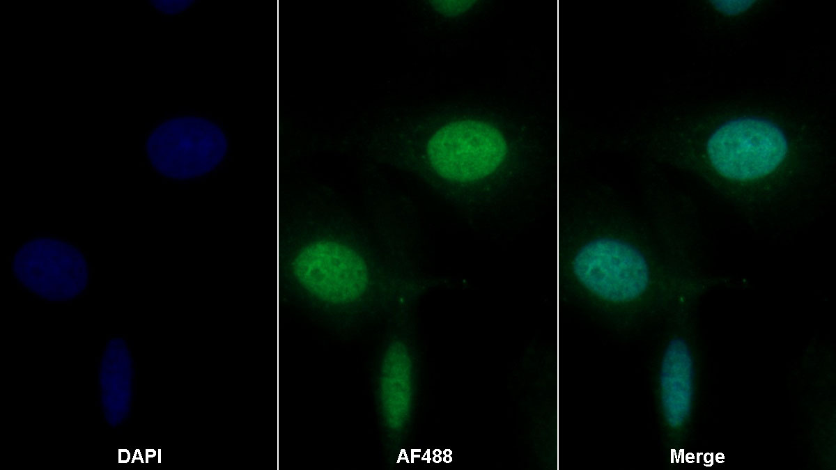 Polyclonal Antibody to Poliovirus Receptor (PVR)