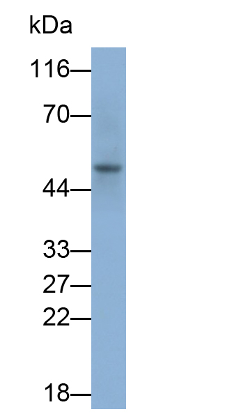 Polyclonal Antibody to Poliovirus Receptor (PVR)