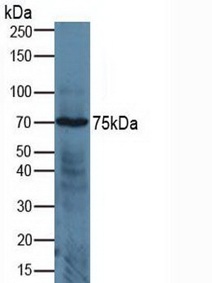 Polyclonal Antibody to A Disintegrin And Metalloprotease 17 (ADAM17)