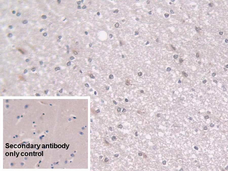 Polyclonal Antibody to Large Multifunctional Peptidase 7 (LMP7)