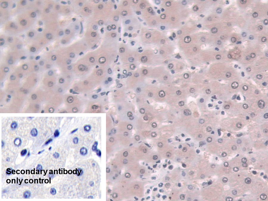 Polyclonal Antibody to Large Multifunctional Peptidase 7 (LMP7)