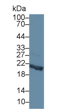 Polyclonal Antibody to Large Multifunctional Peptidase 7 (LMP7)