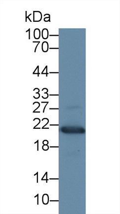 Polyclonal Antibody to Large Multifunctional Peptidase 7 (LMP7)