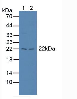 Polyclonal Antibody to Large Multifunctional Peptidase 7 (LMP7)