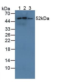 Polyclonal Antibody to Cytochrome P450 Family 21 Subfamily A Member 2 (CYP21A2)