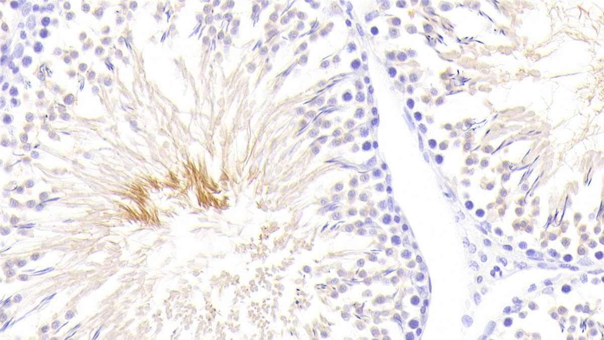 Polyclonal Antibody to Cytochrome P450 Family 21 Subfamily A Member 2 (CYP21A2)