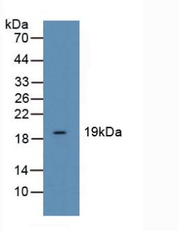 Polyclonal Antibody to Cofilin 1 (CFL1)