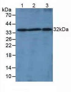 Polyclonal Antibody to Lymphotoxin Beta (LTb)