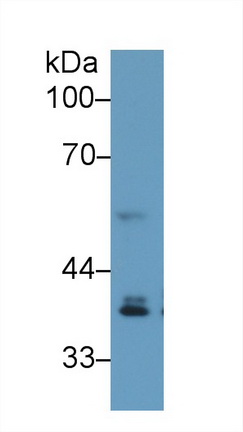 Polyclonal Antibody to Interferon Regulatory Factor 1 (IRF1)