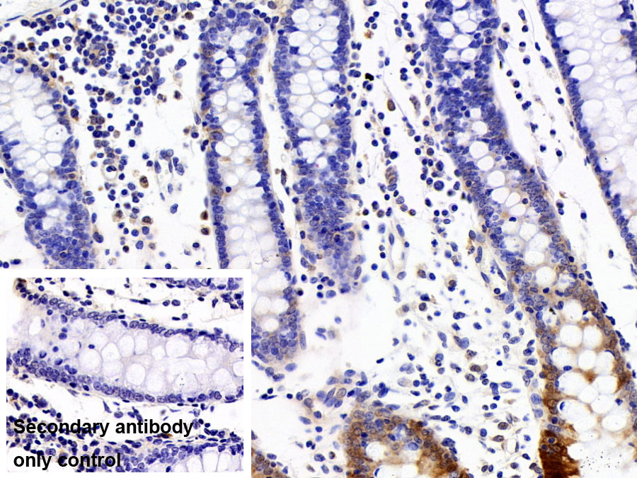 Polyclonal Antibody to Fatty Acid Binding Protein 1 (FABP1)