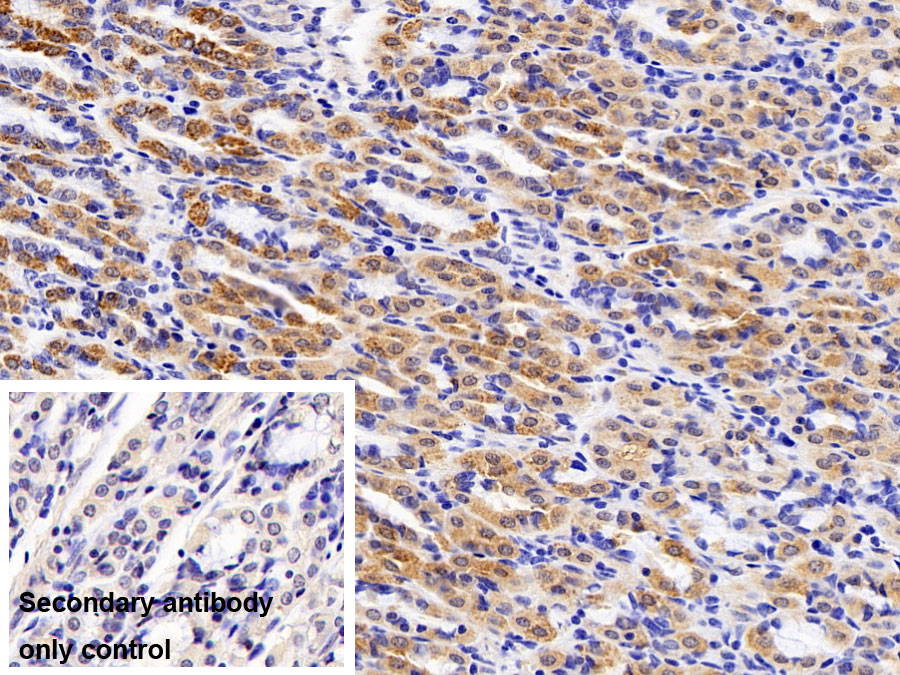 Polyclonal Antibody to Fatty Acid Binding Protein 1 (FABP1)